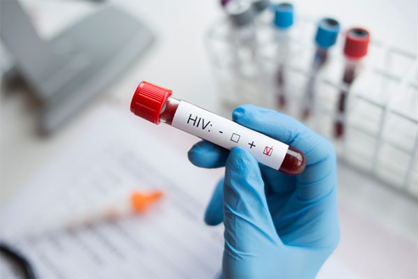 FDA 批准首个用于 HIV 暴露前预防的注射治疗